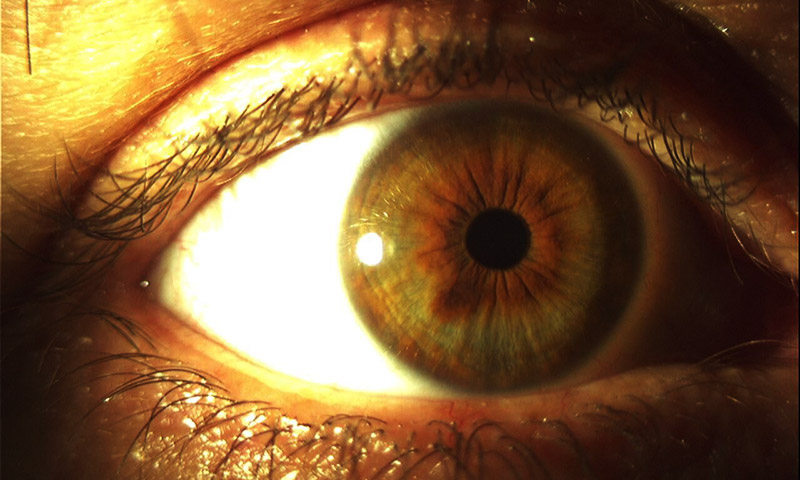 Iridologia